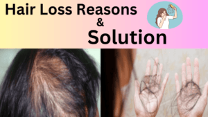 What Are The Main Reasons For Hair Loss [Fall]