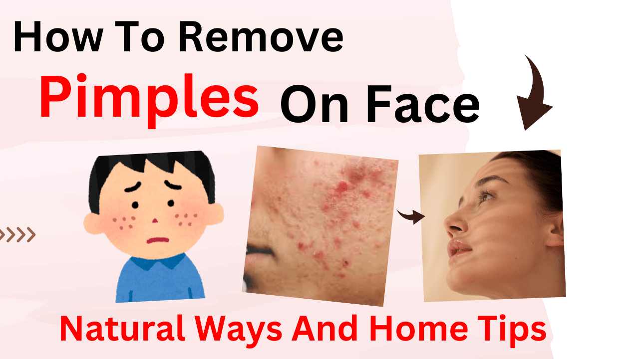 Best ways to remove black pimples on face